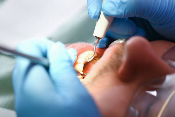 Fast & Reliable Emergency Dental Services in WI