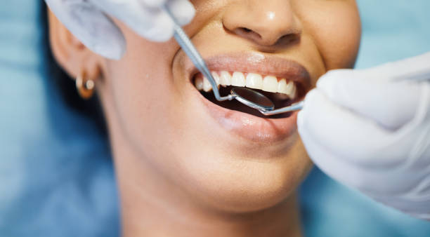 Best Emergency Root Canal Treatment in Kekoskee, WI